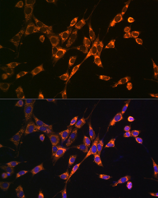 DKK3 Rabbit Polyclonal Antibody - Image 4