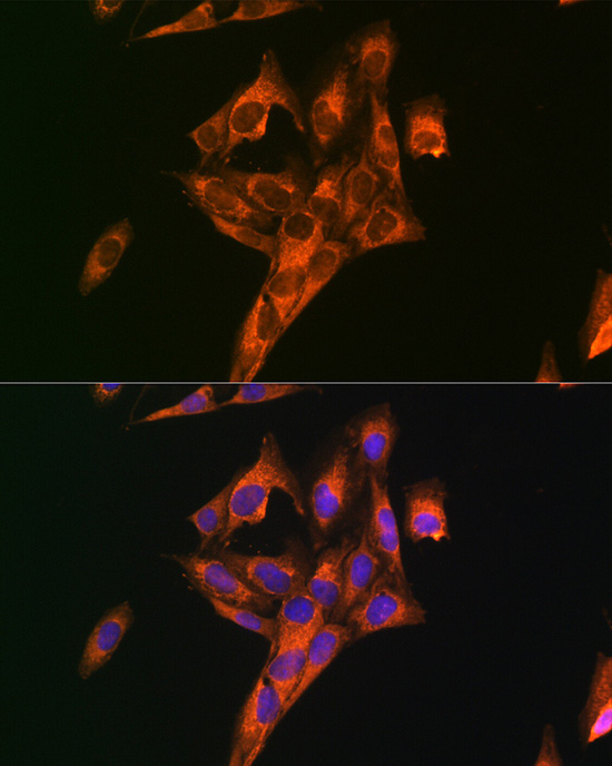 DKK3 Rabbit Polyclonal Antibody - Image 5