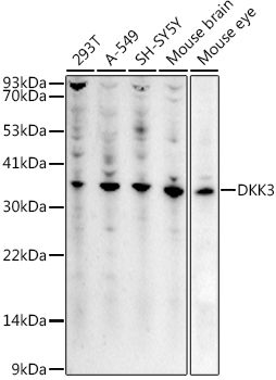 DKK3 Rabbit Polyclonal Antibody