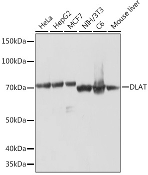 DLAT Rabbit Monoclonal Antibody