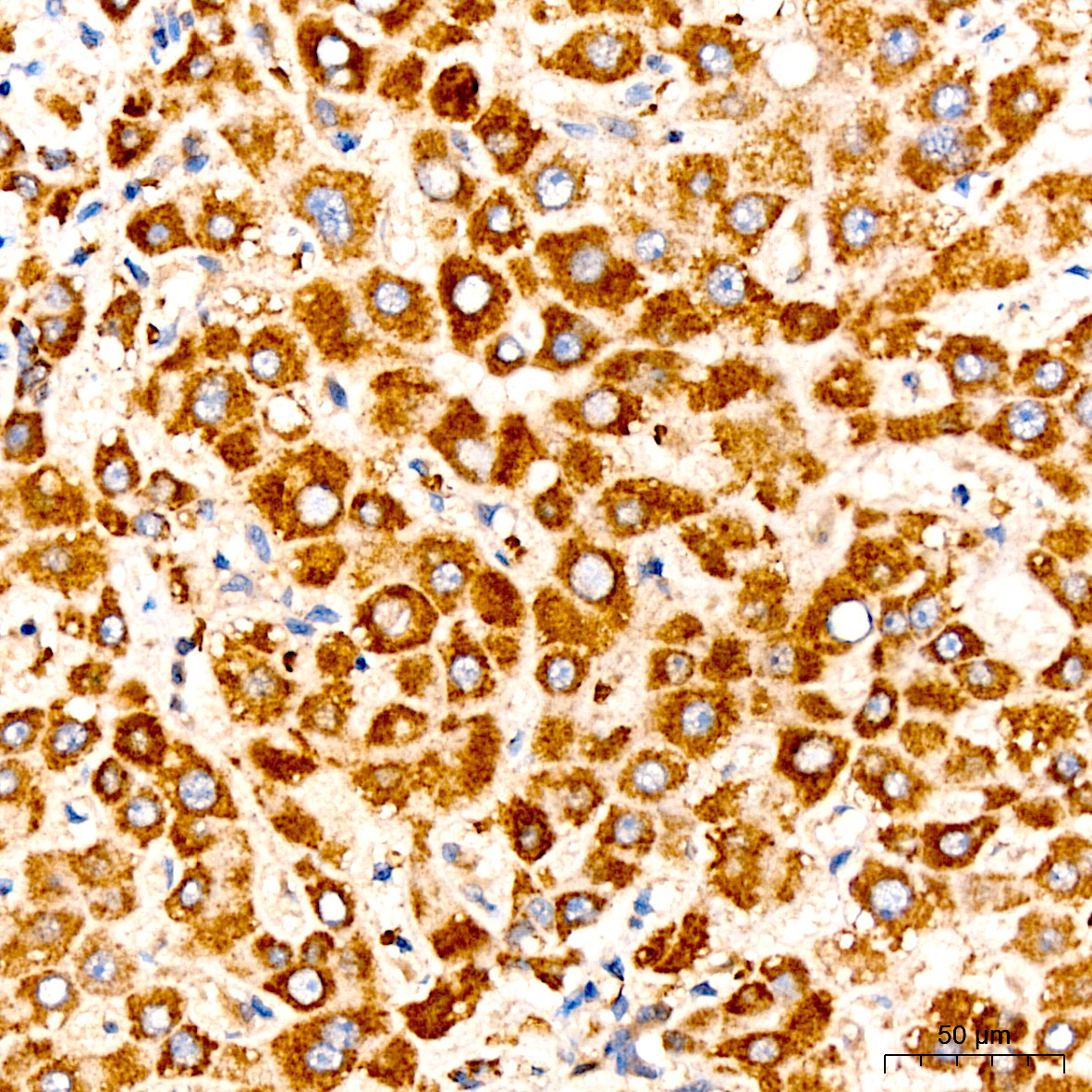 DLAT Rabbit Polyclonal Antibody - Image 2