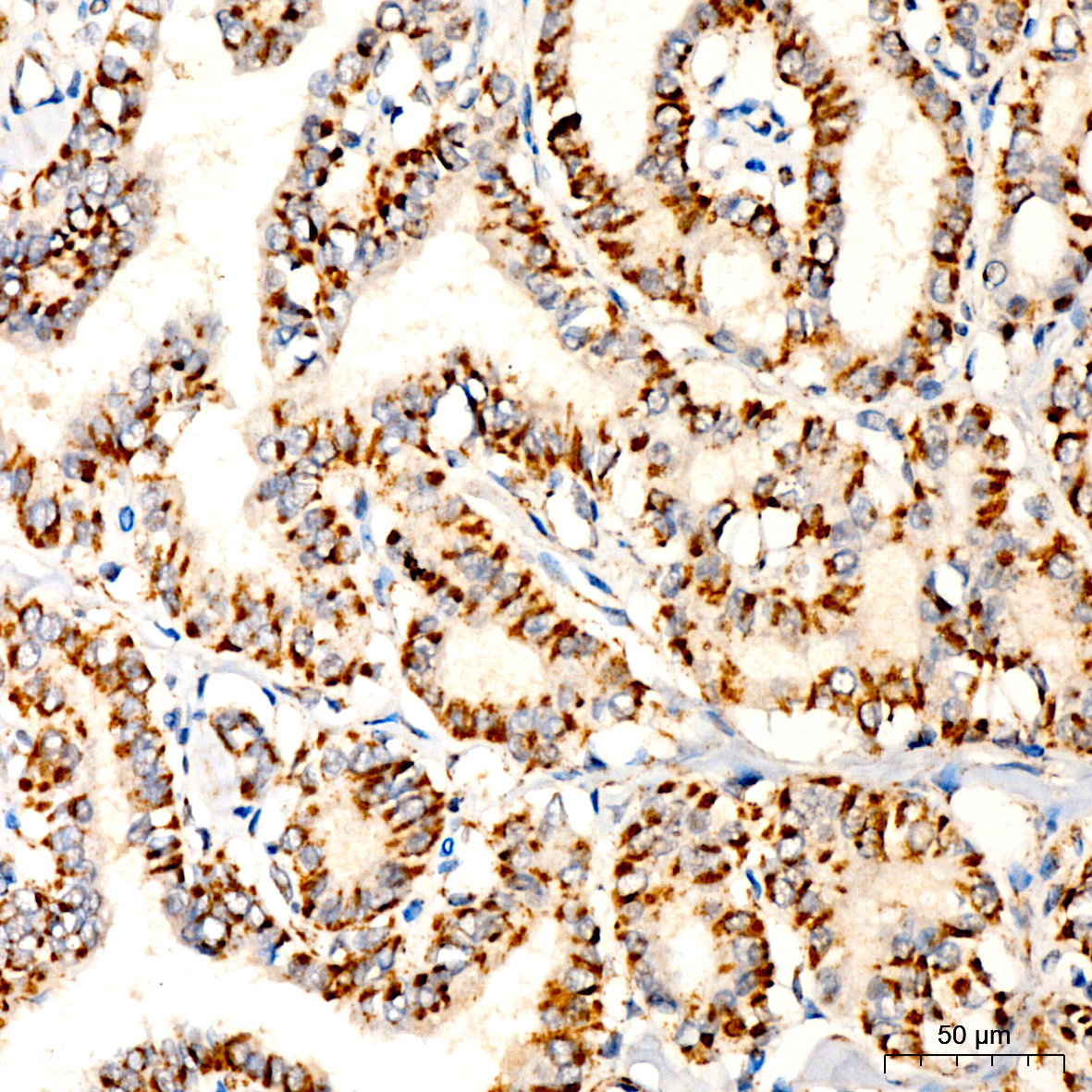 DLAT Rabbit Polyclonal Antibody - Image 3