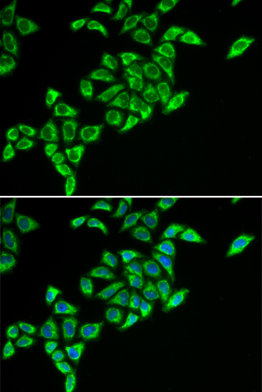 DLAT Rabbit Polyclonal Antibody - Image 2