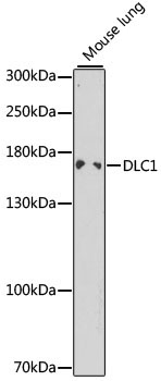 DLC1 Rabbit Polyclonal Antibody