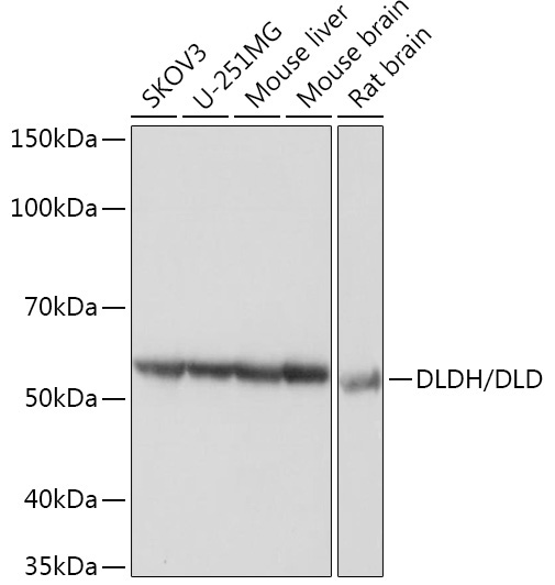 DLDH/DLD Rabbit Monoclonal Antibody