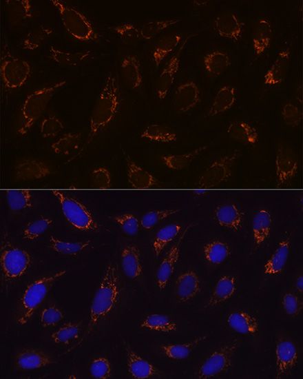DLDH/DLD Rabbit Monoclonal Antibody - Image 2