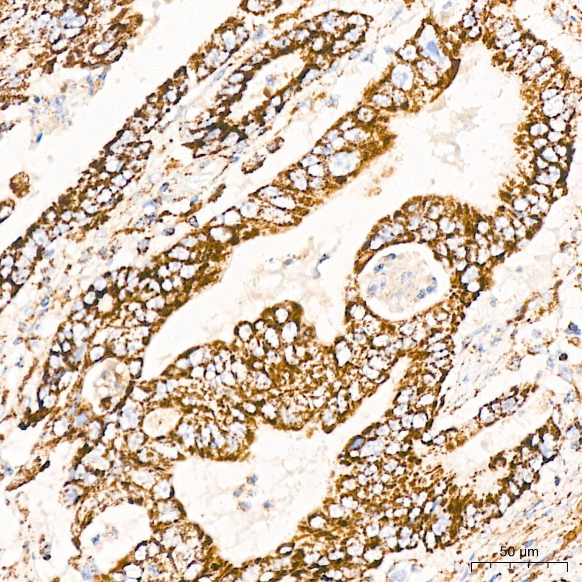 DLDH/DLD Rabbit Monoclonal Antibody - Image 3