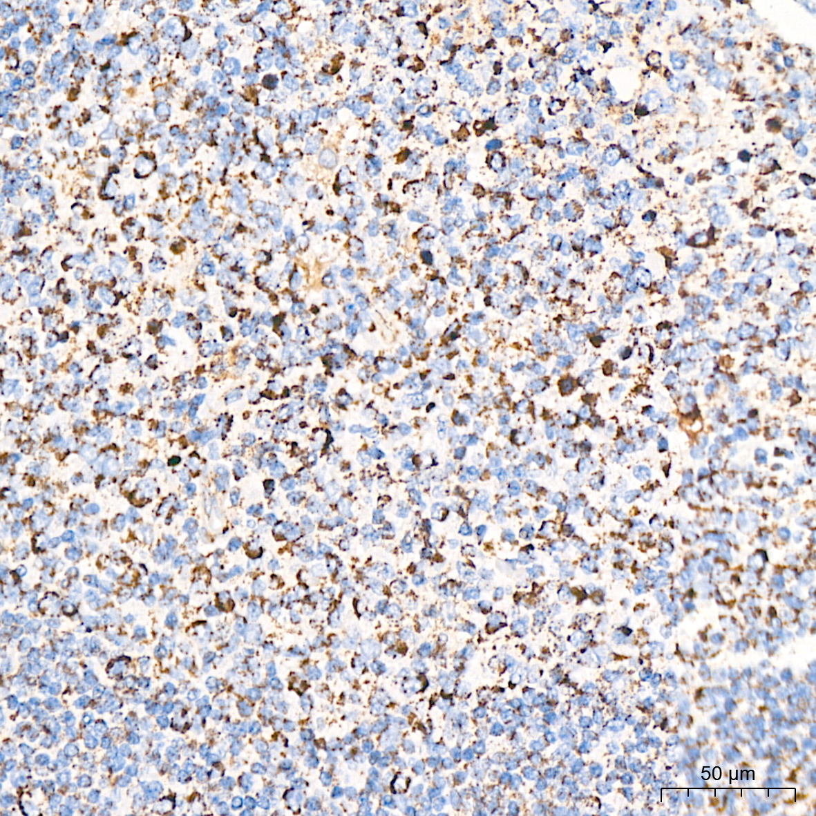 DLDH/DLD Rabbit Monoclonal Antibody - Image 7