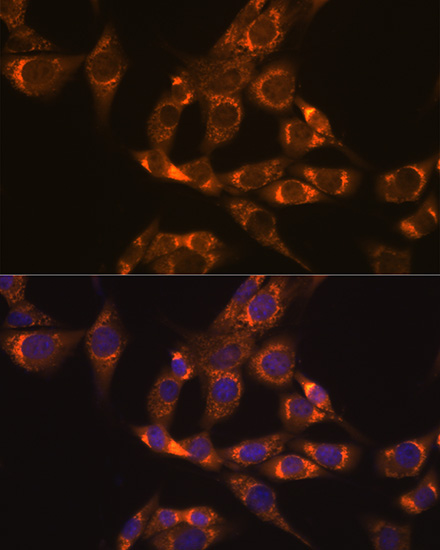 DLDH/DLD Rabbit Monoclonal Antibody - Image 10
