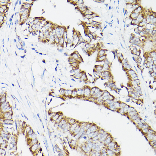 DLDH/DLD Rabbit Polyclonal Antibody - Image 2
