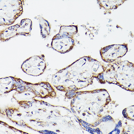 DLDH/DLD Rabbit Polyclonal Antibody - Image 3