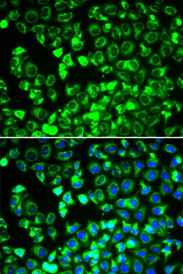 DLDH/DLD Rabbit Polyclonal Antibody - Image 4