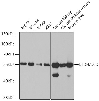 DLDH/DLD Rabbit Polyclonal Antibody