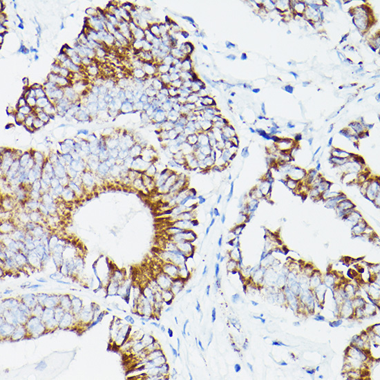 DLDH/DLD Rabbit Polyclonal Antibody - Image 2