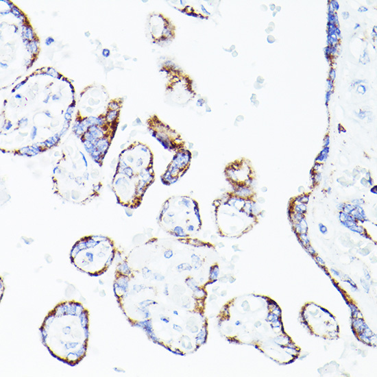 DLDH/DLD Rabbit Polyclonal Antibody - Image 4