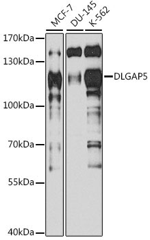 DLGAP5 Rabbit Polyclonal Antibody