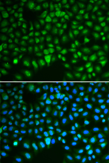 DLGAP5 Rabbit Polyclonal Antibody - Image 2