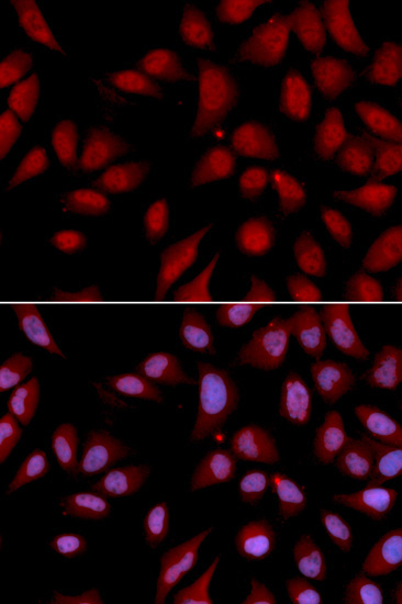 DLGAP5 Rabbit Polyclonal Antibody - Image 2