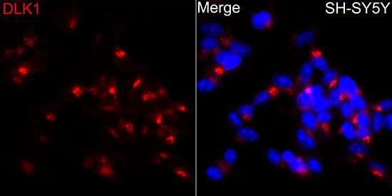DLK1 Rabbit Polyclonal Antibody - Image 2