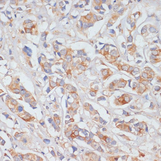DLL1 Rabbit Polyclonal Antibody - Image 3