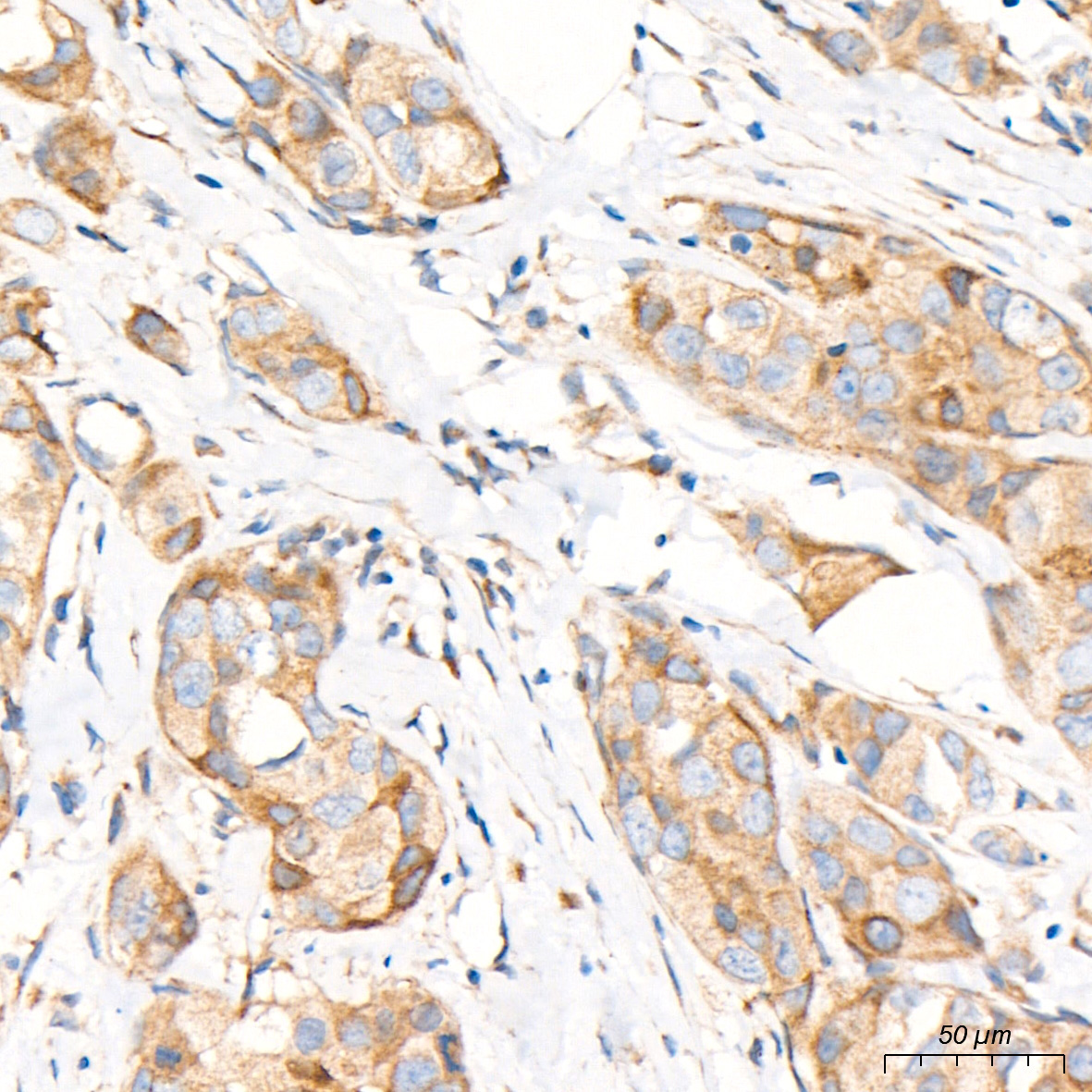 DLL3 Rabbit Polyclonal Antibody - Image 2