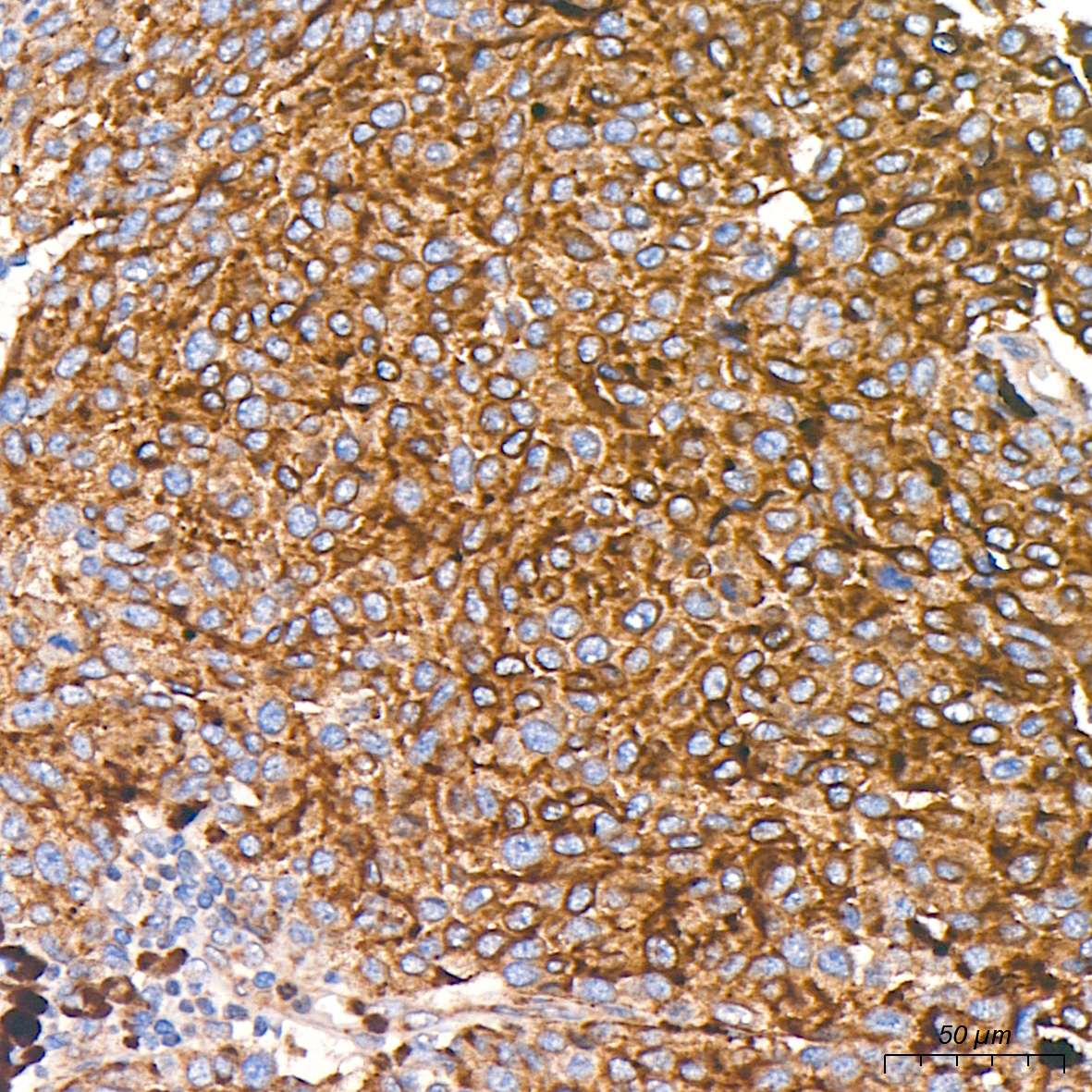 DLL3 Rabbit Polyclonal Antibody - Image 3