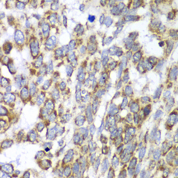 DLST Rabbit Polyclonal Antibody - Image 3