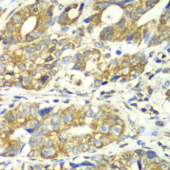 DLST Rabbit Polyclonal Antibody - Image 4