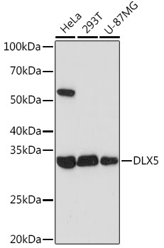DLX5 Rabbit Monoclonal Antibody