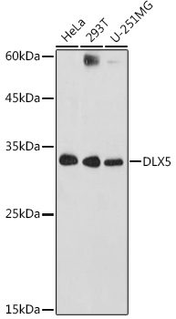 DLX5 Rabbit Polyclonal Antibody