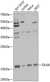 DLX6 Rabbit Polyclonal Antibody