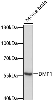 DMP1 Rabbit Polyclonal Antibody