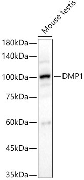 DMP1 Rabbit Polyclonal Antibody