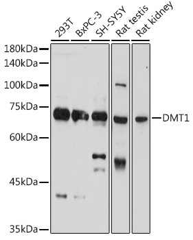 DMT1/SLC11A2 Rabbit Polyclonal Antibody