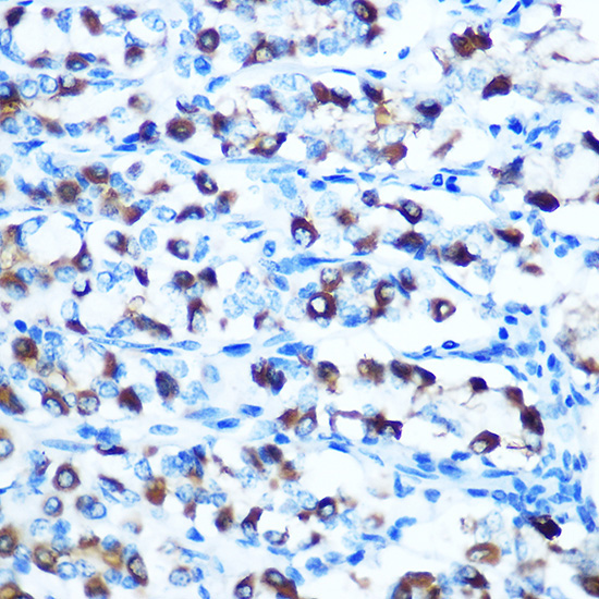 DMT1/SLC11A2 Rabbit Polyclonal Antibody - Image 2