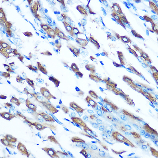 DMT1/SLC11A2 Rabbit Polyclonal Antibody - Image 3