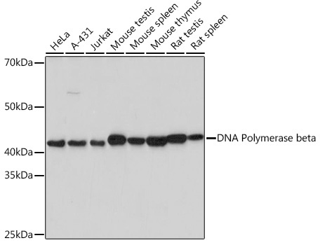 DNA Polymerase beta Rabbit Monoclonal Antibody
