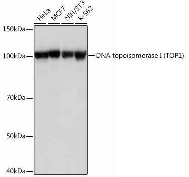 DNA topoisomerase I (TOP1) Rabbit Monoclonal Antibody