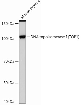 DNA topoisomerase I (TOP1) Rabbit Monoclonal Antibody - Image 2