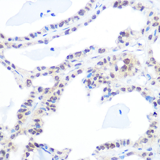 DNA topoisomerase I (TOP1) Rabbit Monoclonal Antibody - Image 3
