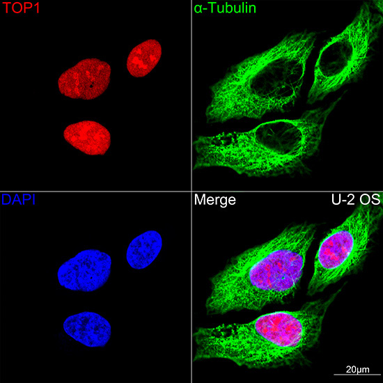 DNA topoisomerase I (TOP1) Rabbit Monoclonal Antibody - Image 4