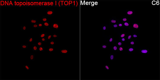 DNA topoisomerase I (TOP1) Rabbit Monoclonal Antibody - Image 6