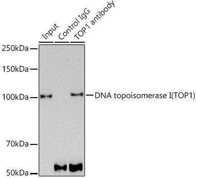 DNA topoisomerase I (TOP1) Rabbit Monoclonal Antibody - Image 7