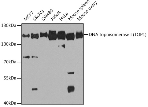 DNA topoisomerase I (TOP1) Rabbit Polyclonal Antibody