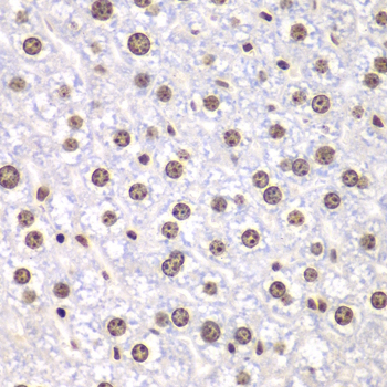 DNA topoisomerase I (TOP1) Rabbit Polyclonal Antibody - Image 2