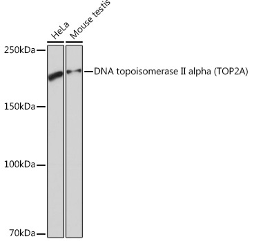 DNA topoisomerase II alpha (TOP2A) Rabbit Monoclonal Antibody