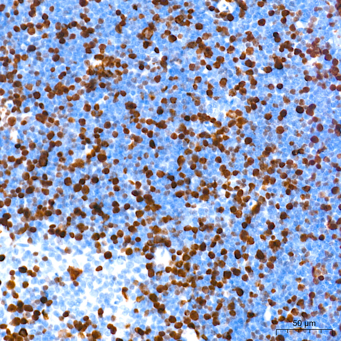 DNA topoisomerase II alpha (TOP2A) Rabbit Monoclonal Antibody - Image 2