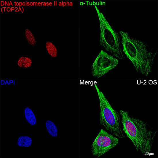 DNA topoisomerase II alpha (TOP2A) Rabbit Monoclonal Antibody - Image 3