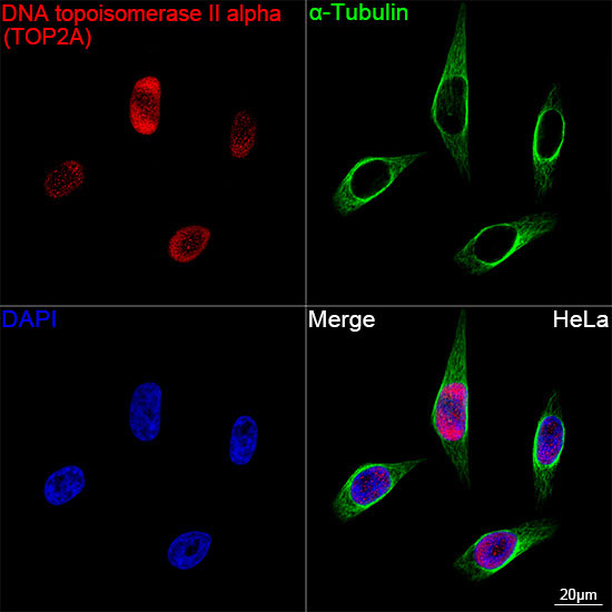 DNA topoisomerase II alpha (TOP2A) Rabbit Monoclonal Antibody - Image 4