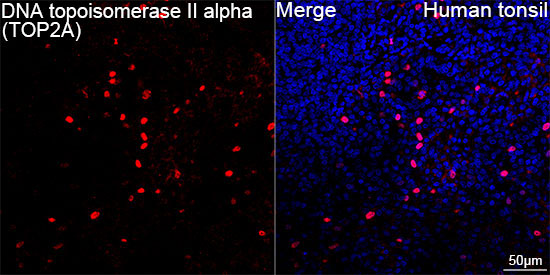 DNA topoisomerase II alpha (TOP2A) Rabbit Monoclonal Antibody - Image 5